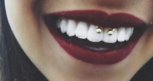 Smiley Piercing: Pros, Cons & Pain